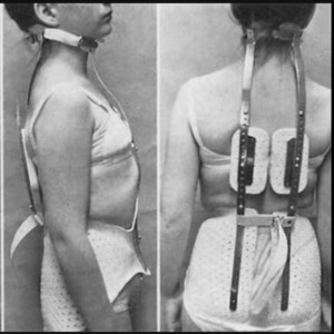 back braces example